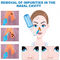 Nasal Wash Bottle (NWB3) Nasal Wash Bottle (NWB3)