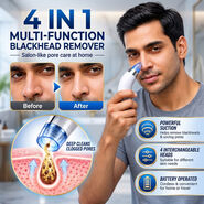 4 In 1 Multi-Function Blackhead Remover (BHR3)