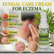 Fungal Care Cream For Eczema (BCER)