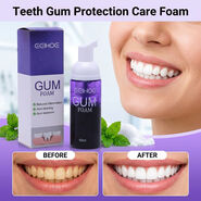 Teeth Gum Protection Care Foam (ORC7)