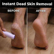 Rechargeable Dead Skin Remover For Feet (RFF7)