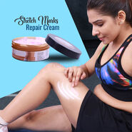 Stretch Marks Repair Cream (SMRC)