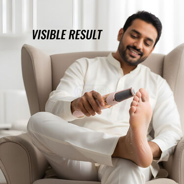 Rechargeable Callus Remover For Feet (RFF5)