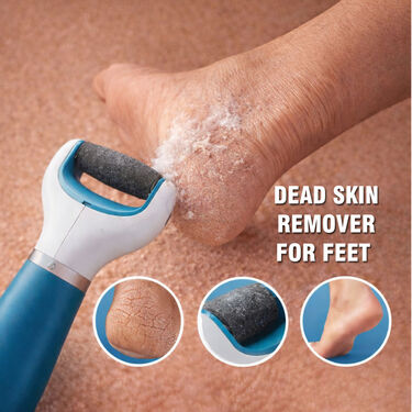 Dead Skin Remover For Feet (RFF6)