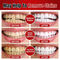 Ultra Teeth Whitening Paste (OC1)