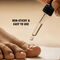 Toenail Care & Comfort Drops (CD FCRD)
