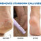 Rechargeable Dead Skin Remover For Feet (RFF7)