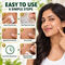 Massa Remover Pack of 36 Patches (BC29)
