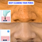 4-In-1 Blackhead Remover Vacuum (BHR4)