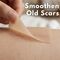 Silicone Scar Hiding Tape (BC30)
