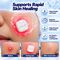 Pack 6 Electronic Acne Patches (PCP1)