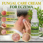 Fungal Care Cream For Eczema (BCER)