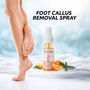 Foot Callus Removal Spray (CD-FCRS)