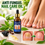 Anti Fungus Nail Care Oil (FTCR5)